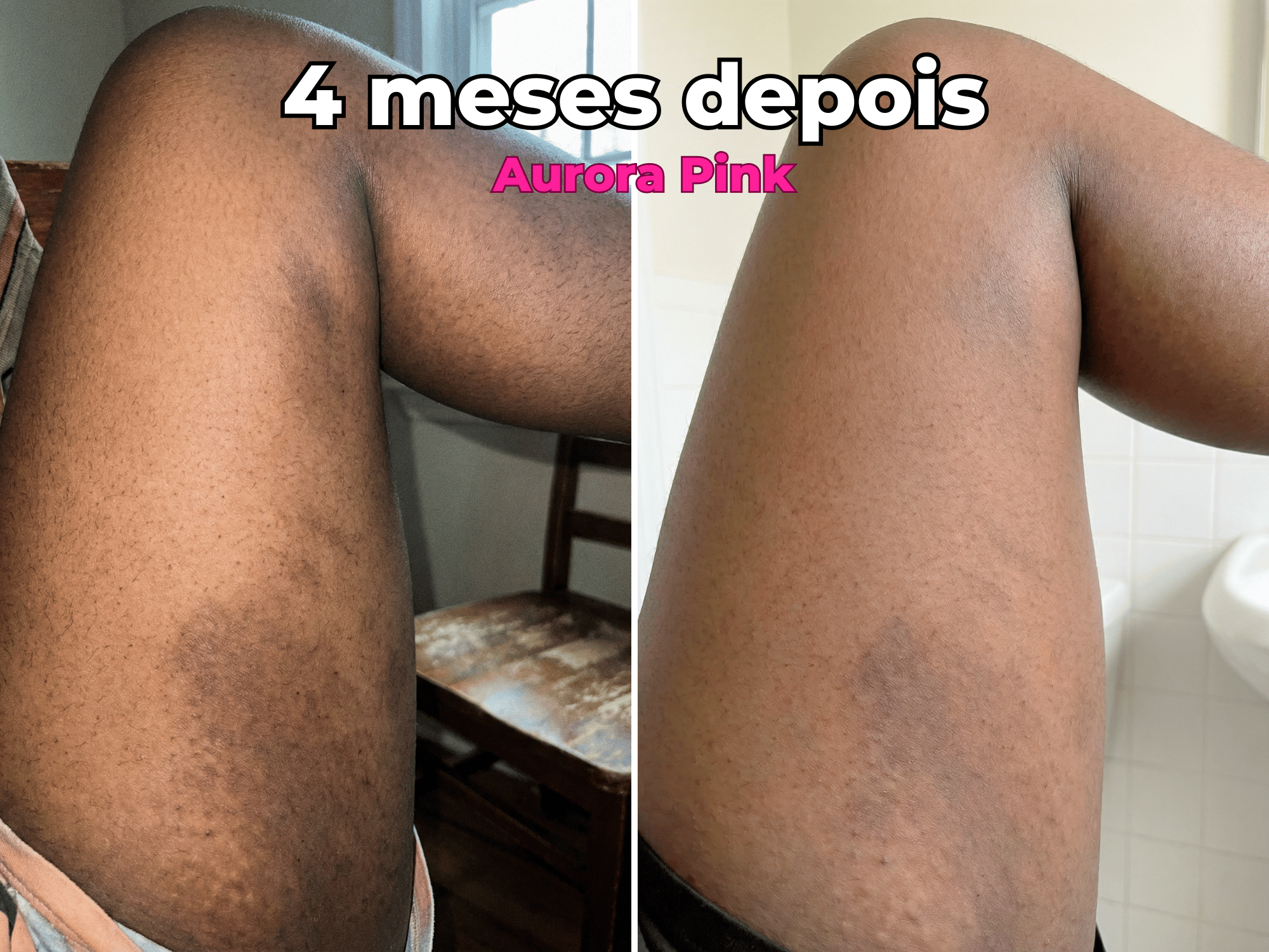 Antes e Depois 1