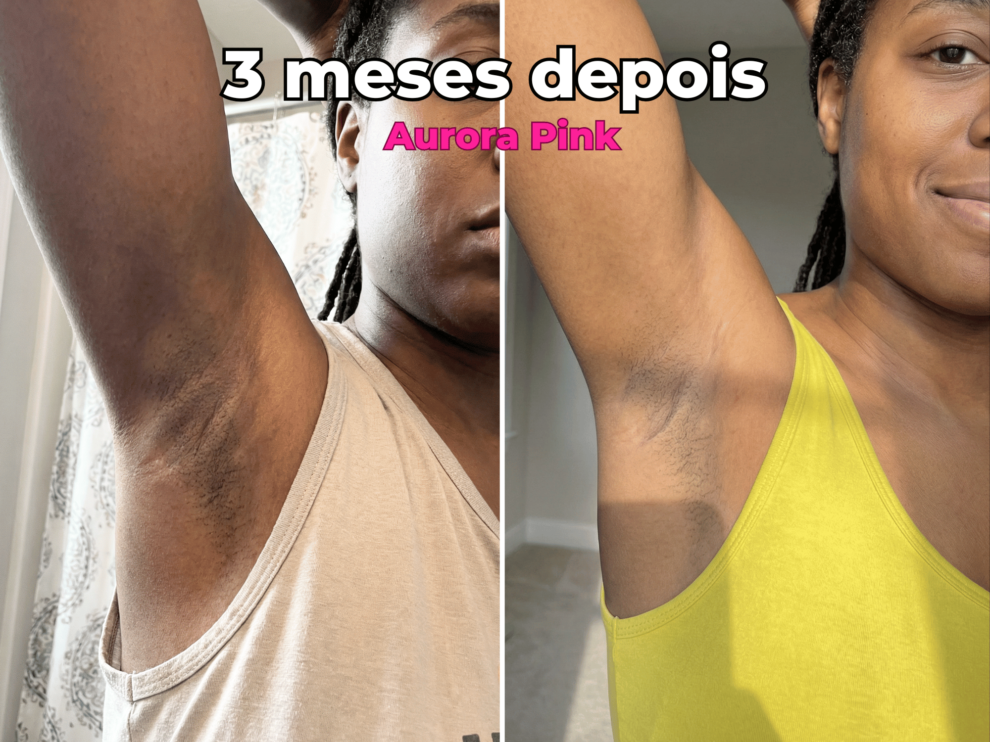 Antes e Depois 2